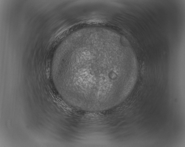 X0000076351015200610201754