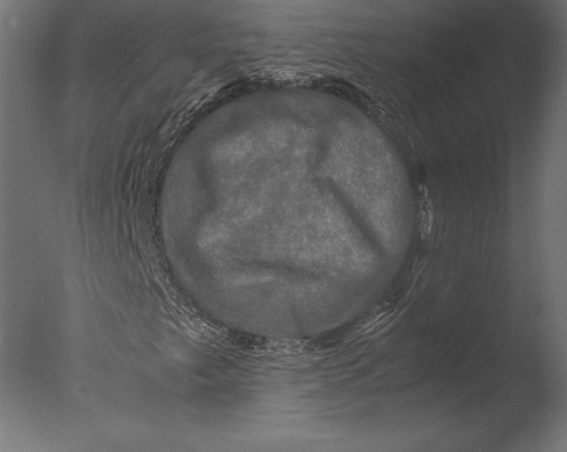 X0000076351249200610201751