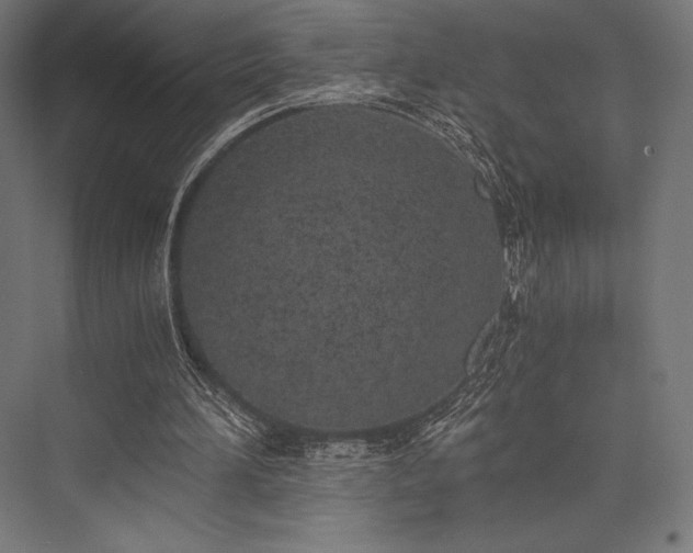 X0000076370196200610061107