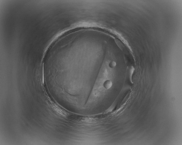 X0000076381175200610061117