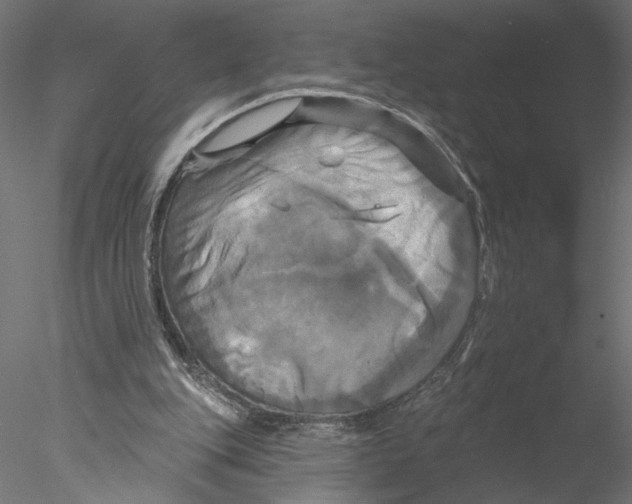 X0000076380151200611031638