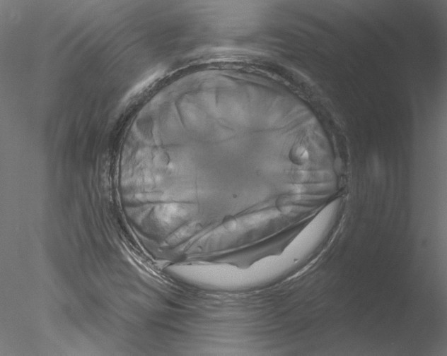 X0000076381403200611031617