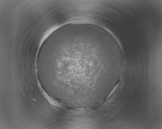 X0000076381485200611031616