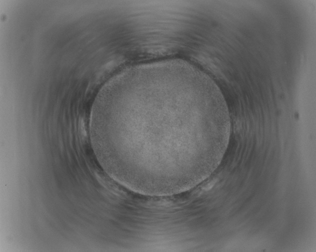 X0000076391106200610202057