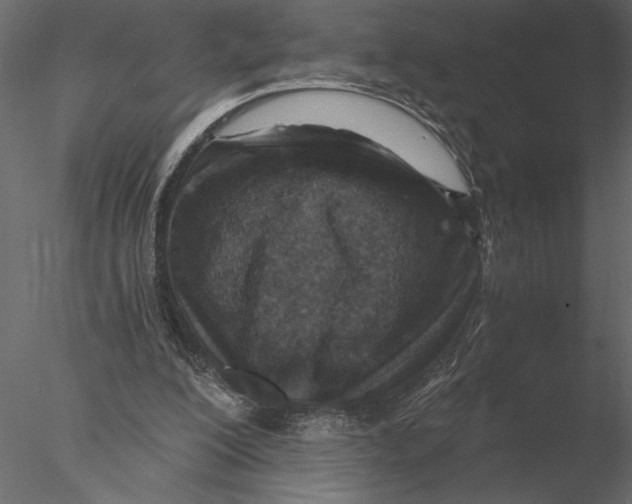 X0000076390200200611031704