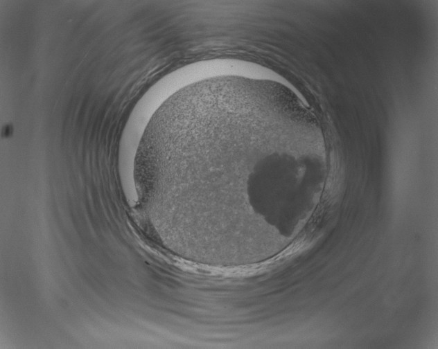 X0000076420048200611031825