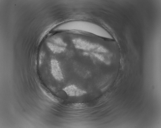 X0000076430059200611031850