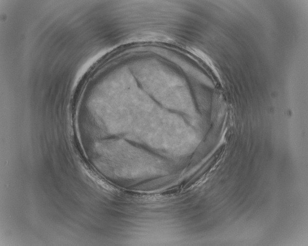 X0000077291120200611171620