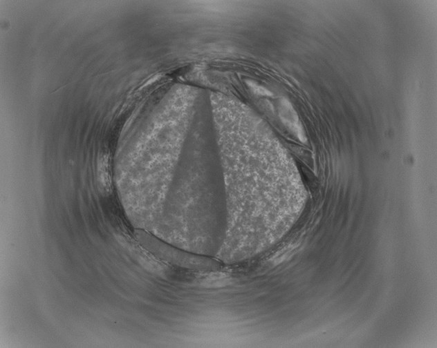 X0000077291156200611171620