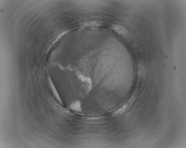 X0000077291401200611171615