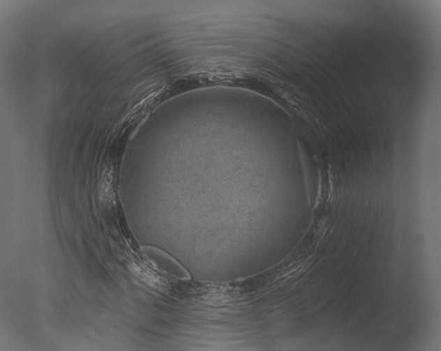 X0000077311060200610201147