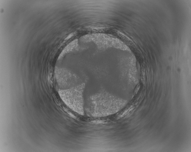 X0000077311010200611171712