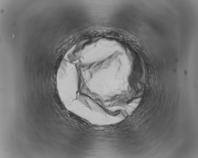 X0000077311397200611171705