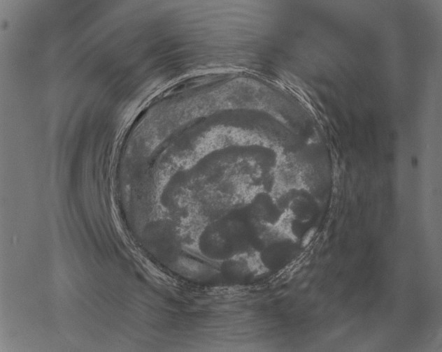 X0000077320145200611101507