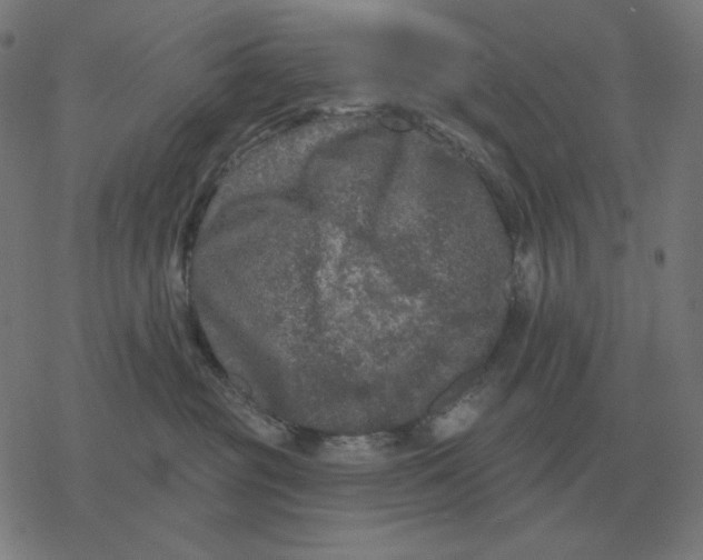 X0000077320381200611101504