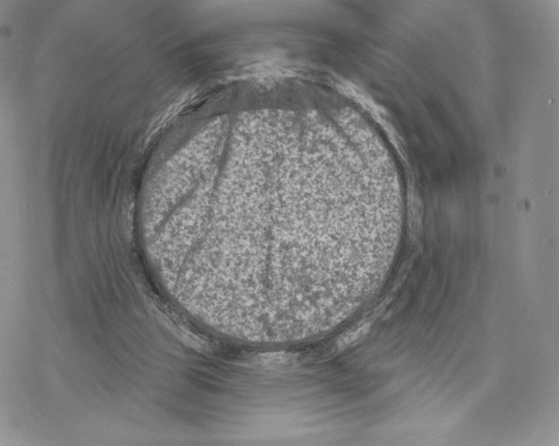 X0000077320153200611171751