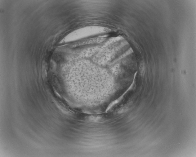 X0000077320570200611171745