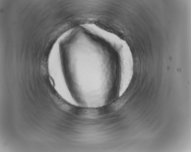 X0000077320719200611171742