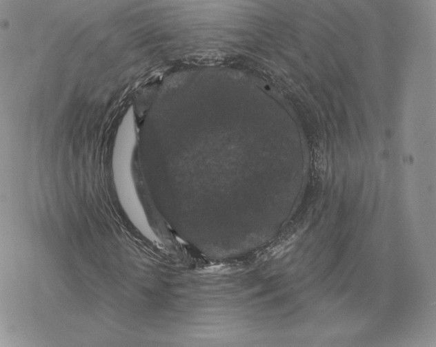 X0000077320818200611171740