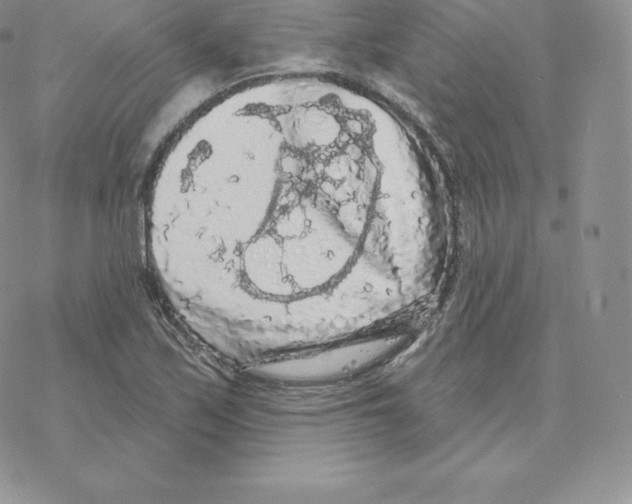 X0000077321171200611171735