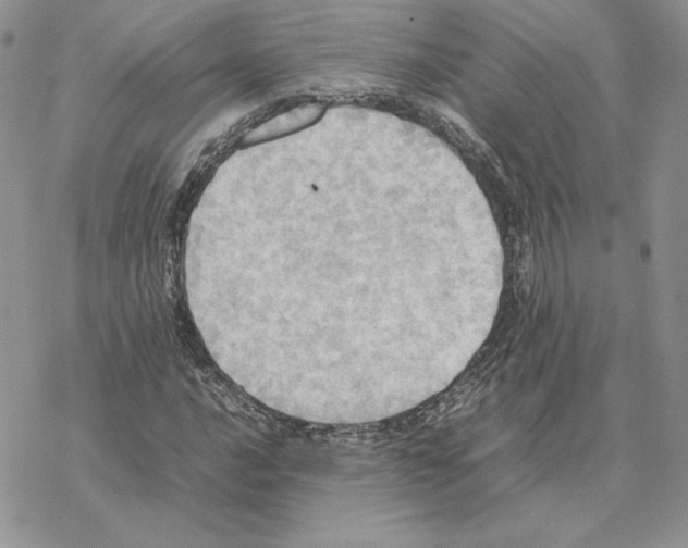 X0000077331016200611171802