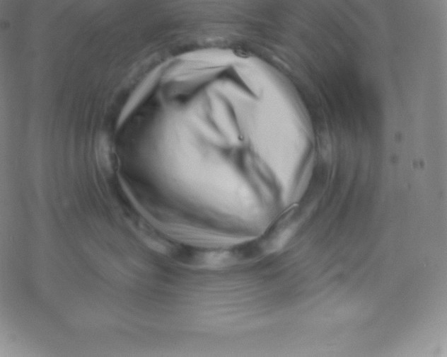 X0000077350575200611101617