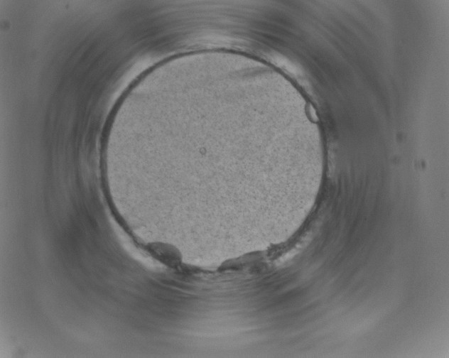 X0000077351039200611101609