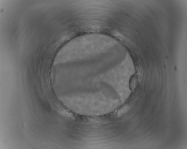 X0000077351057200611101608