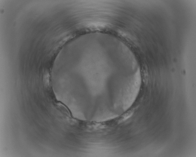 X0000077351061200611101608