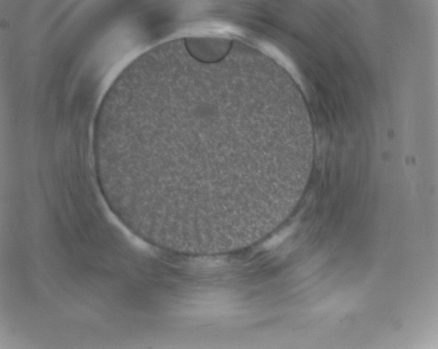 X0000077351103200611101607