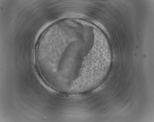 X0000077351128200611101607