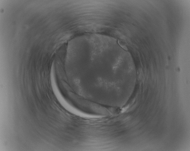 X0000077351202200611101605