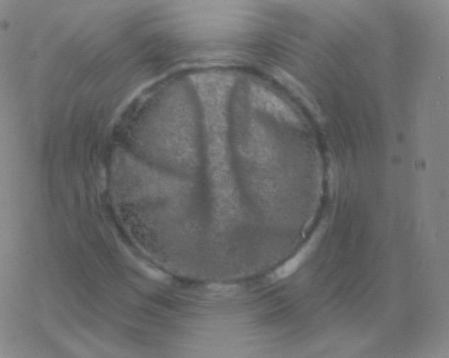 X0000077351449200611101602