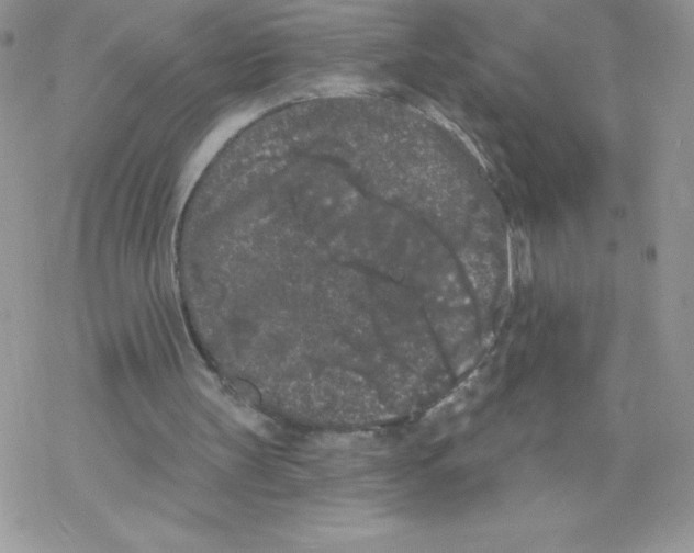 X0000077350147200611171907