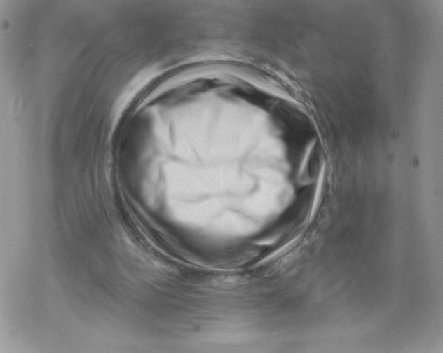 X0000077350152200611171907