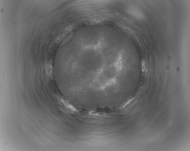 X0000077351011200611171852