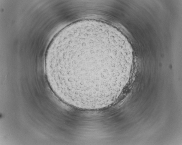 X0000077351036200611171853