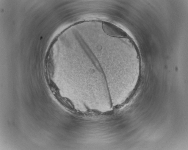 X0000077351045200611171853