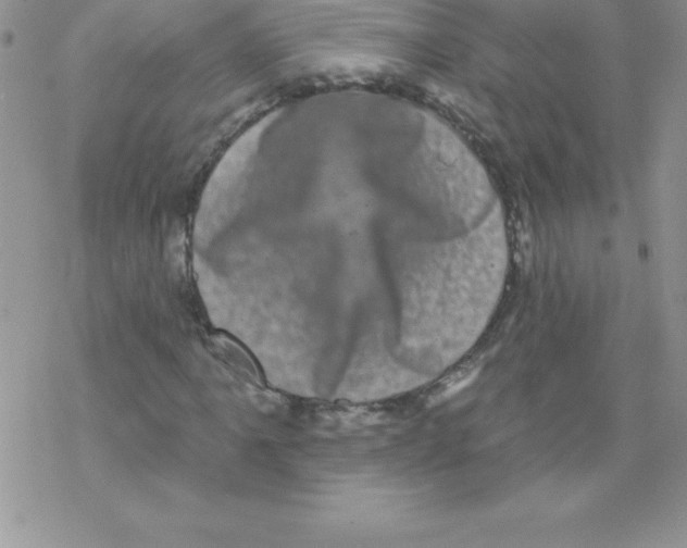 X0000077351061200611171852