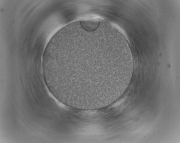 X0000077351103200611171852