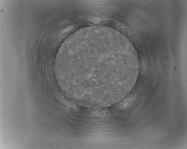 X0000077351105200611171851