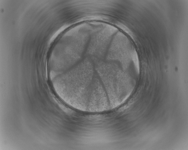 X0000077351127200611171851