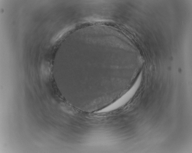 X0000077351157200611171851