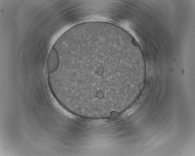 X0000077351387200611171847