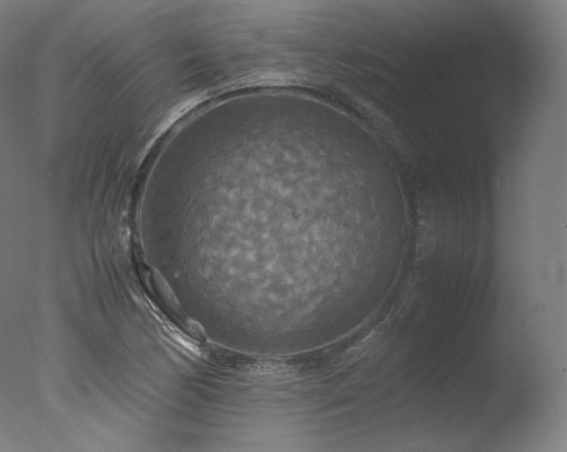 X0000077361170200610201315
