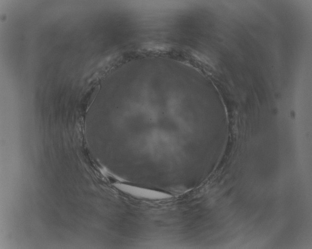 X0000077361397200611031834