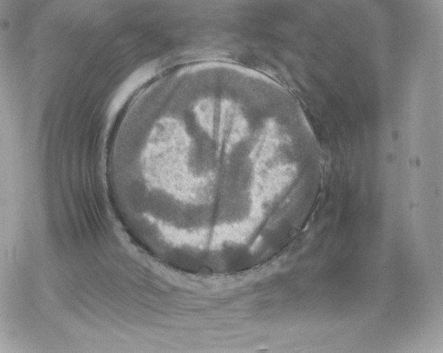 X0000077360006200611171935