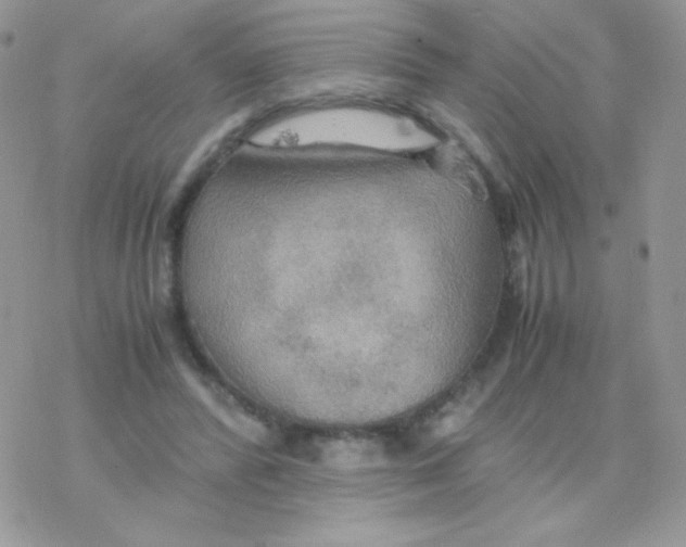 X0000077360400200611171928