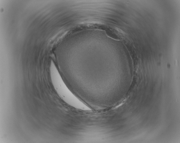 X0000077361014200611171918