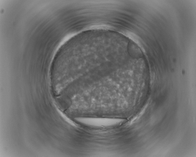 X0000077361037200611171918